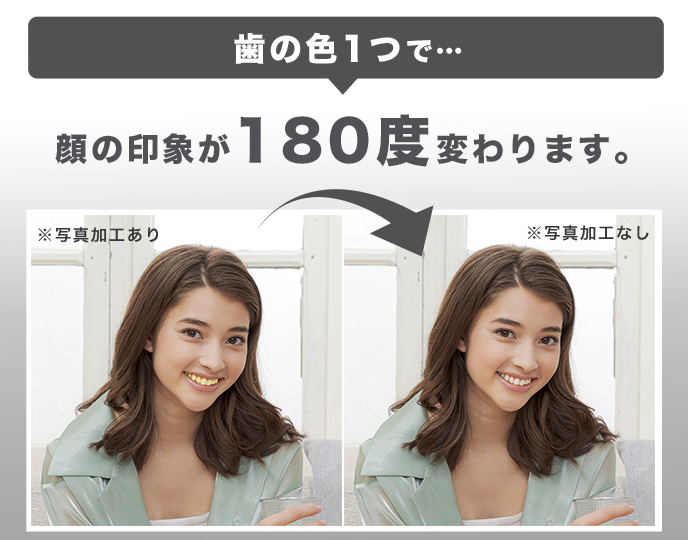 スーパーホワイトlv 販売店
